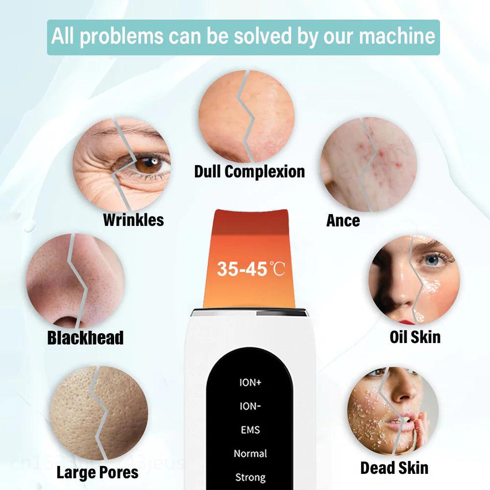 Ultrasonic Blackhead Remover & Skin Rejuvenation Device