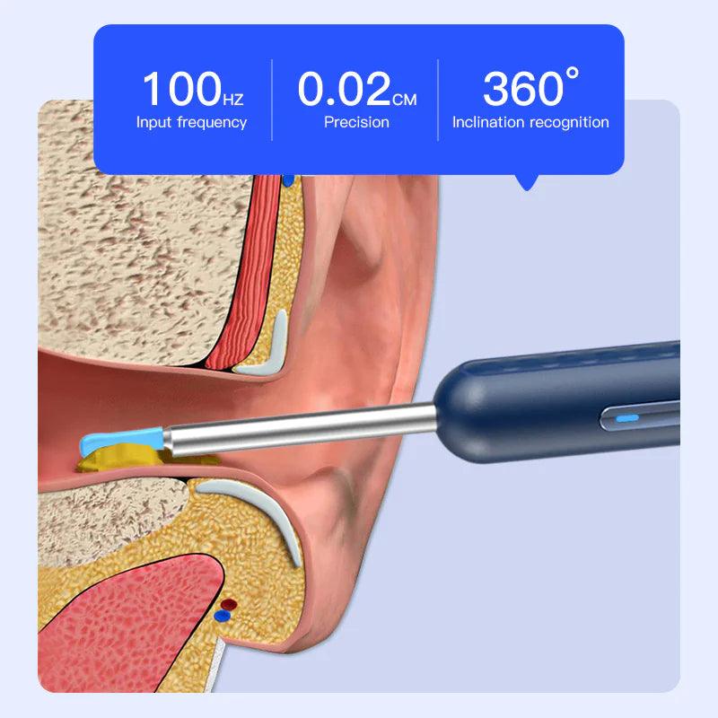 Endoscopio Visual Earpick Strumenti intelligenti per la raccolta dell'orecchio WiFi