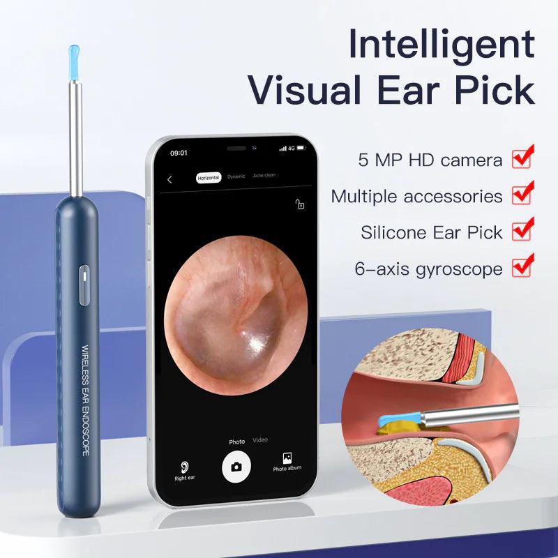 Endoscopio Visual Earpick Strumenti intelligenti per la raccolta dell'orecchio WiFi